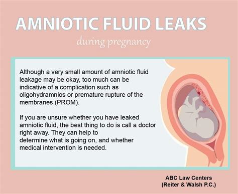 leaking amniotic fluid look like|Leaking Amniotic Fluid: Signs, Causes, and。